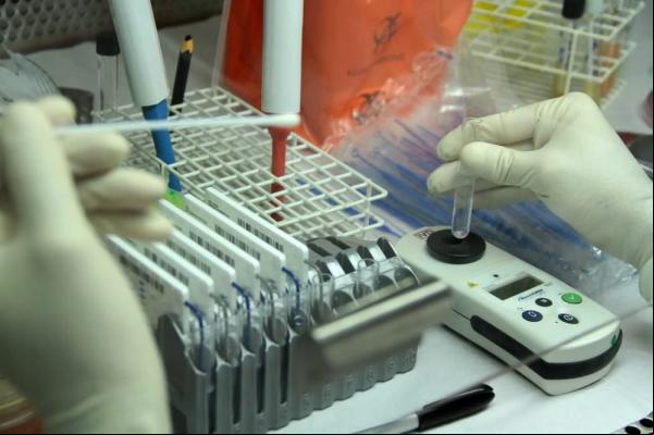 Laboratório Central de Saúde Pública (Lacen) examina casos suspeitos.(Imagem:Diêgo Holanda/G1)