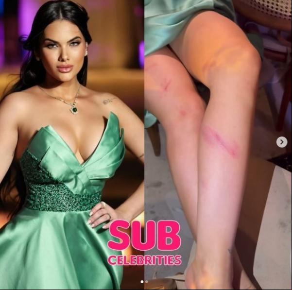 Emily Garcia se machucou ao pegar o buquê das noivas.(Imagem:Reprodução/Instagram)