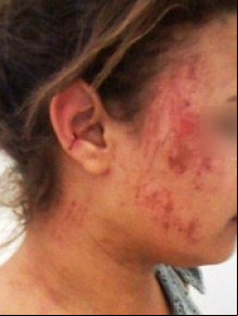Estudante foi baleada de raspão.(Imagem:Weslley Paz/ Portal Campo Maior em Foco)