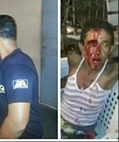 Agressão aconteceu em Tersina(Imagem:Karlos Ribeiro)