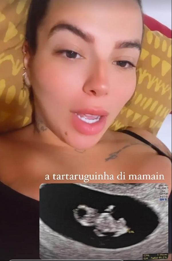 Petra mostra primeiro ultrassom.(Imagem:Reprodução/Instagram )
