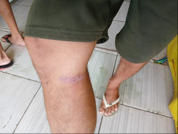  Morador denuncia perigo causado por animais soltos na PI-140 em Floriano(Imagem:FlorianoNews)