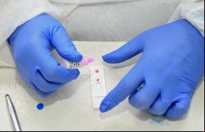 Positividade de testes da covid volta a subir e associação de medicina faz alerta(Imagem:Divulgação)