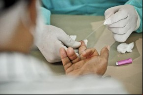 Dos 241 casos confirmados da doença 135 são mulheres e 106 são homens, com idades entre um a 90 anos.  Os casos confirmados no estado somam 327.816 em todos os municípios piauiense(Imagem:Reprodução)