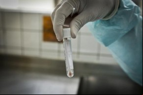 Os casos confirmados no estado somam 325.695 em todos os municípios piauienses. Já os óbitos pelo novo coronavírus chegam a 7.099 e foram registrados em 223 municípios.  Dos leitos(Imagem:Reprodução)