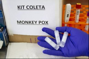 Sobe para 17 o número de casos suspeitos de varíola dos macacos no Piauí(Imagem:ADRIANA TOFFETTI)