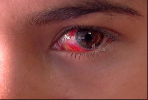 Mãe agride a filha com as unhas e acaba lesionando o olho da garota.(Imagem:Divulgação)