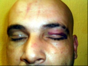 Alexandre tirou fotos logo após a agressão que foi registrada na delegacia ao aeroporto. (Imagem: Arquivo Pessoal)