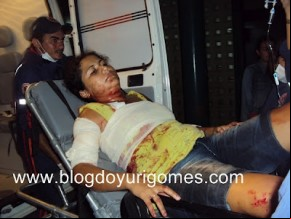 Mulher é agredida violentamente com 10 furadas de canivete pelo ex- namorado.(Imagem:Blog do Yuri Gomes)