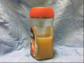 Peritos podem recorrer ao exterior para descobrir substância que matou criança.(Imagem:Divulgação)