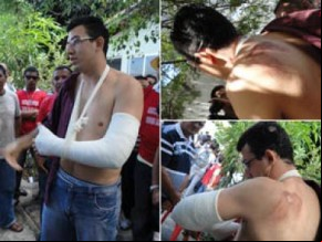 Alexandre Rios foi atropelado durante protesto da PM.(Imagem:Reprodução)