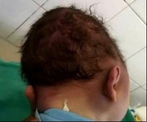 Corpo da criança será exumado.(Imagem:Divulgação)
