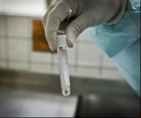 O Piauí registrou 42 casos confirmados e um óbito por Covid-19, segundo os dados divulgados pela Secretaria de Estado da Saúde, nesta terça-feira (21).  Dos 42 casos confirmados da(Imagem:Reprodução)