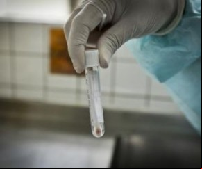 O Piauí registrou 433 casos confirmados e três óbitos de Covid-19, segundo os dados divulgados pela Secretaria de Estado da Saúde, nesta quinta-feira (7).  Dos 433 casos confirmado(Imagem:Reprodução)