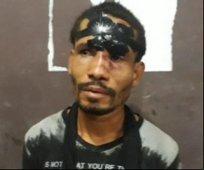Homem é detido por lesão corporal em Floriano.(Imagem:Reprodução)