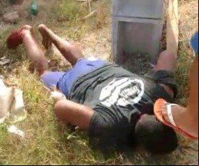 Suspeito de assalto é espancado e tem perna quebrada por moradores em Teresina(Imagem:Reprodução)