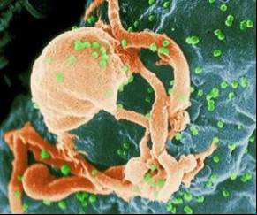 Expectativa de vida de infectados com HIV já está perto do normal.(Imagem:Divulgação)