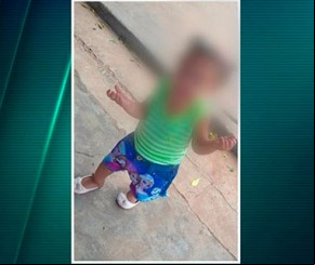 Criança feita de escudo pelo próprio pai tem alta da UTI, mas estado ainda é grave(Imagem:florianonews.piauiconectado.com)
