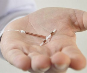 Ministério amplia o ao contraceptivo DIU no Sistema Único de Saúde.(Imagem:Divulgação)