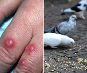 Ciência Viva explica por que não se deve alimentar pombos.(Imagem:florianonews.piauiconectado.com)