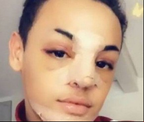 Pabllo Vittar a por três cirurgias de uma vez só.(Imagem:Instagram)