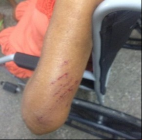 Idosa é agredida pelo próprio filho em Parnaíba.(Imagem:florianonews.piauiconectado.com)