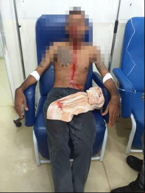 Suspeito baleado(Imagem:Reprodução)