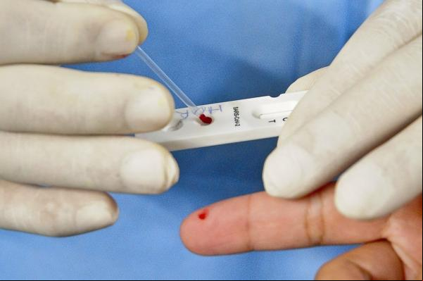 Piauí registra 165 casos confirmados e dois óbitos por Covid-19 nas últimas 24 horas(Imagem:Divulgação)