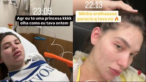 Virginia Fonseca teve reação alérgica.(Imagem:Reprodução)
