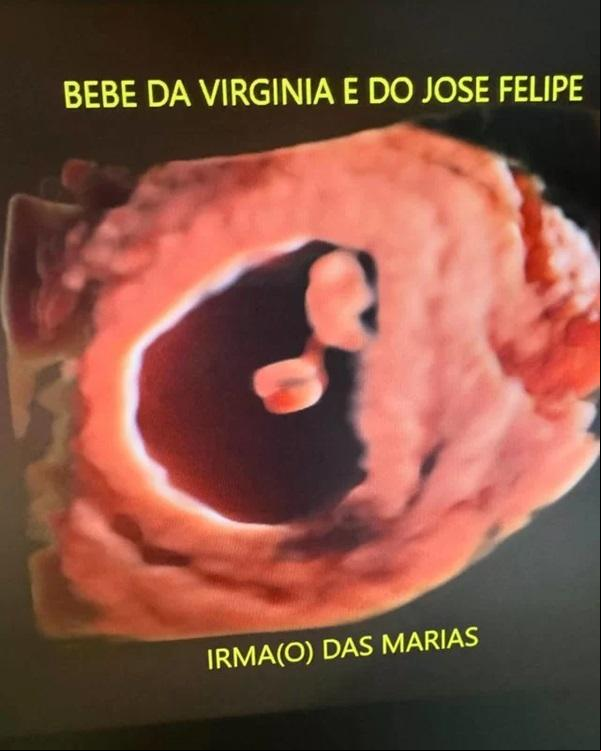 Virgínia compartilhou as primeiras imagens de ultrasson de seu terceiro filho(Imagem:Reprodução/Instagram)
