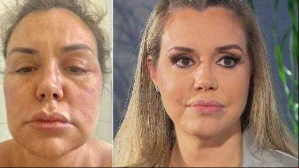 Renata Banhara desabafa: