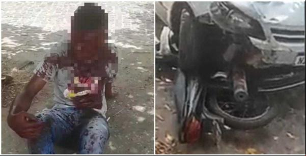 Vítima reage a assalto, atropela e quebra perna do bandido em Teresina(Imagem:Reprodução)