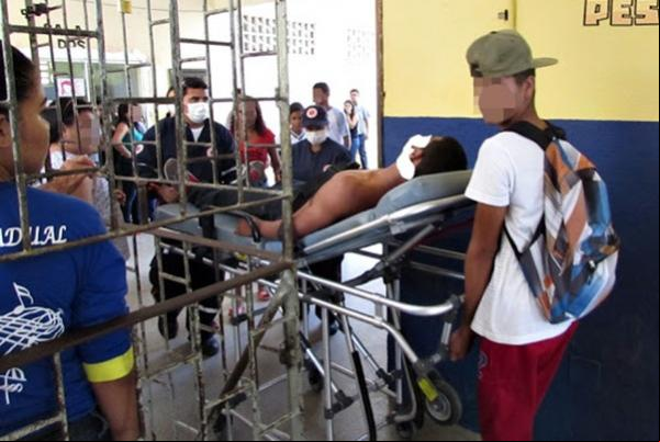 Estudante de 17 anos é atingido com tiro no rosto dentro de escola.(Imagem:florianonews.piauiconectado.com)