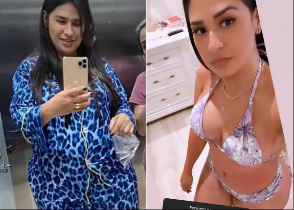 Simone posa de biquíni para mostrar o corpo após abdominoplastia e emagrecimento.(Imagem:Reprodução / Instagram)