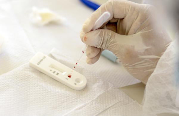 Uma mulher recém-chegada do Congo testou positivo para o coronavírus no último domingo, 28, após ter apresentado sintomas da doença desde o dia 22, em Belo Horizonte, quando procur(Imagem:Reprodução)