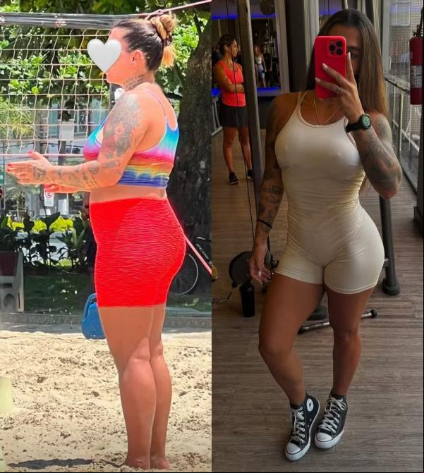 Filha de Maurício Mattar, Petra Mattar mostra antes e depois.(Imagem:Reprodução/Instagram)