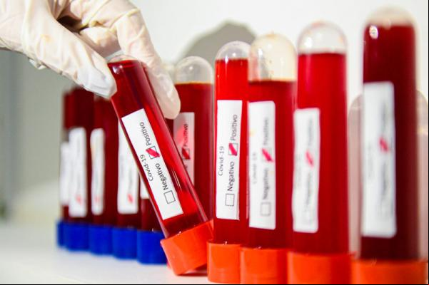 Piauí ultraa 110 mil casos do coronavírus; mortes caem 12,8% em uma semana(Imagem:Eduardo Valente/FramePhoto/Folhapress)