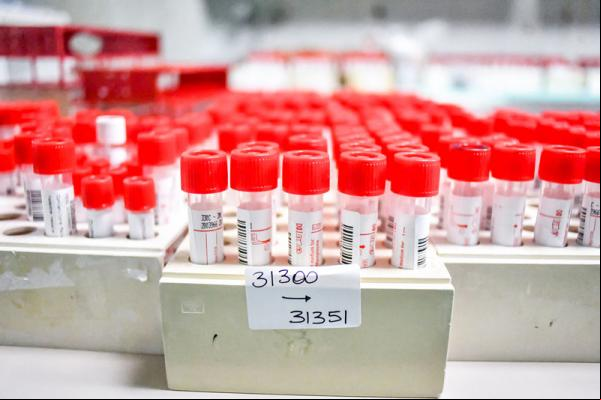 Lacen aguarda resultado de 15 amostras para confirmar presença de variante no Piauí(Imagem:Claudio Furlan)