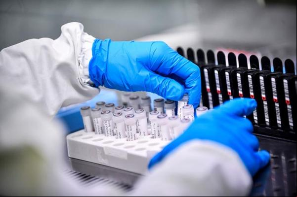 Israel registrou nesta semana um caso raro de infecção dupla de gripe e Covid-19. Apelidada de