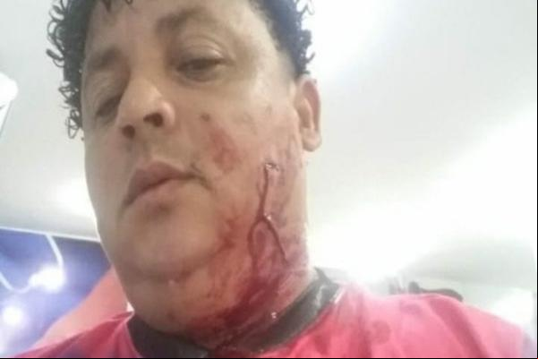 Músico é esfaqueado no rosto durante assalto na cidade de Parnaíba(Imagem:Reprodução)