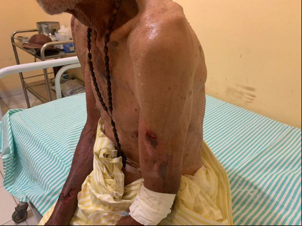 Idoso é submetido a sessões de tortura(Imagem:Divulgação/PM)