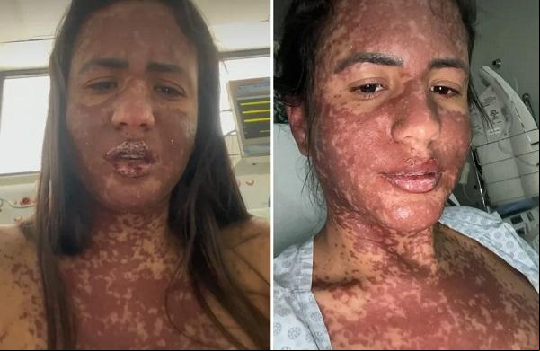 Mulher de Frank Aguiar relata internação na UTI com com doença rara.(Imagem:Reprodução/Instagram)