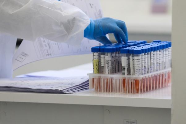 Testes;exames;coronavírus;Covid-19(Imagem:Divulgação/Geraldo Bubniak/AEN)