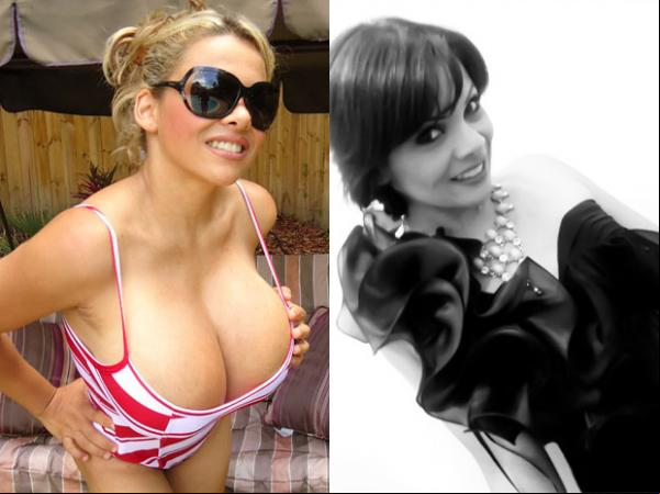 Sheyla Hershey em imagem do ano ado, com os implantes de 3,5 litros e em foto recente, após retirar as próteses.(Imagem:Arquivo pessoal)