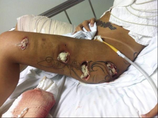 Andressa Urach durante internação em dezembro de 2014.(Imagem: Grosby Group/ Agência)