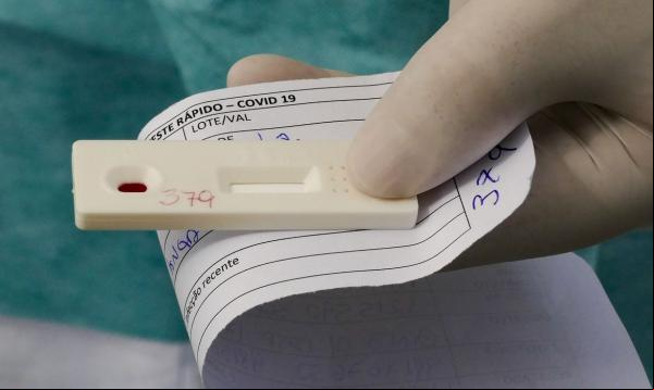 ANS decide se testes para covid-19 continuam obrigatórios.(Imagem:Leopoldo Silva/Agência Senado)