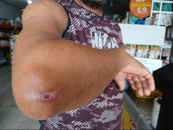  Morador denuncia perigo causado por animais soltos na PI-140 em Floriano(Imagem:FlorianoNews)
